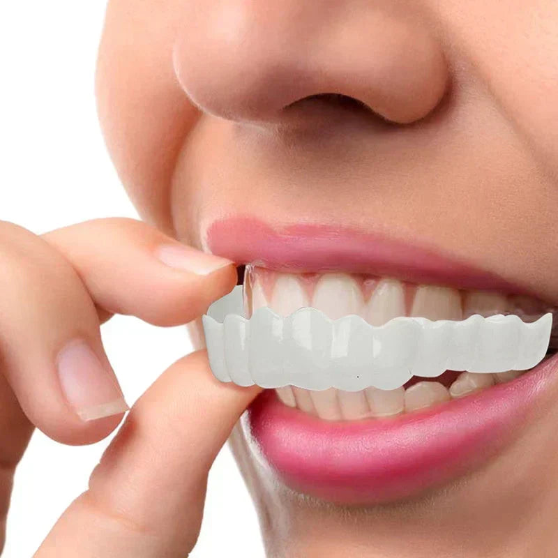 NewSmile - Snap-On Dentures™