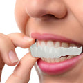 NewSmile - Snap-On Dentures™