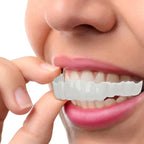 NewSmile - Snap-On Dentures™