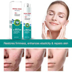 ScarRemove Advanced Scar Spray For All Types of Scars - For example Acne Scars. Surgical Scars and Stretch Marks ™