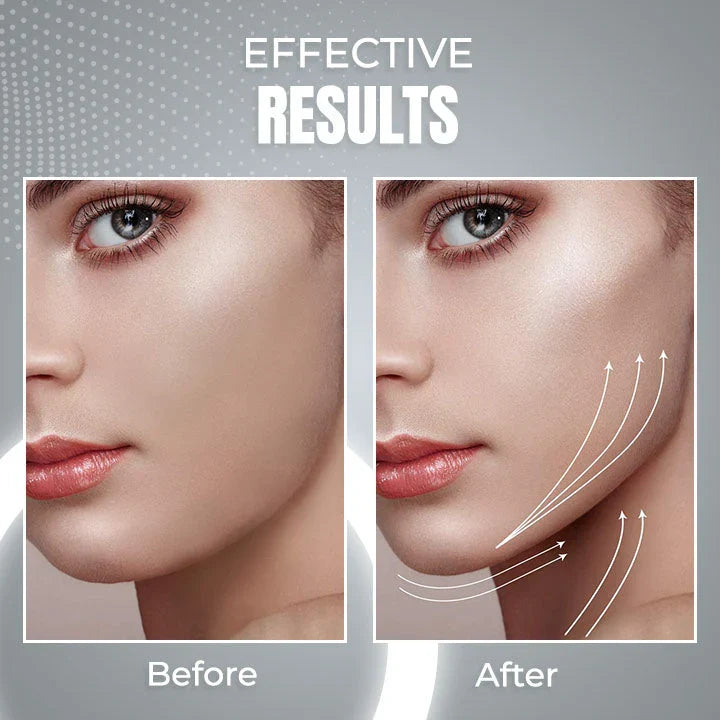 AntiChin - 2 in 1 Anti Snoring and Anti-Aging Facial Contouring Device 50 off™