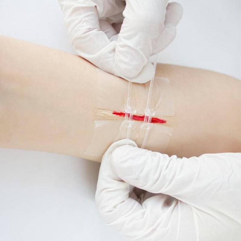 AdhesiveZipper ™ - Zipper Band First-Aid Kit - Cartnoova
