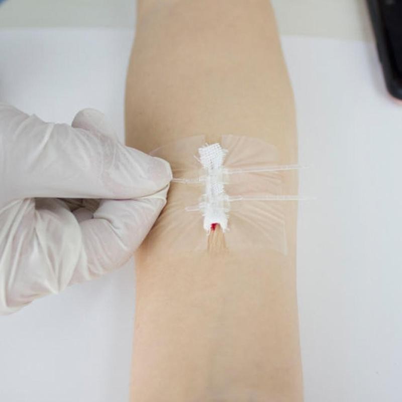 AdhesiveZipper ™ - Zipper Band First-Aid Kit - Cartnoova