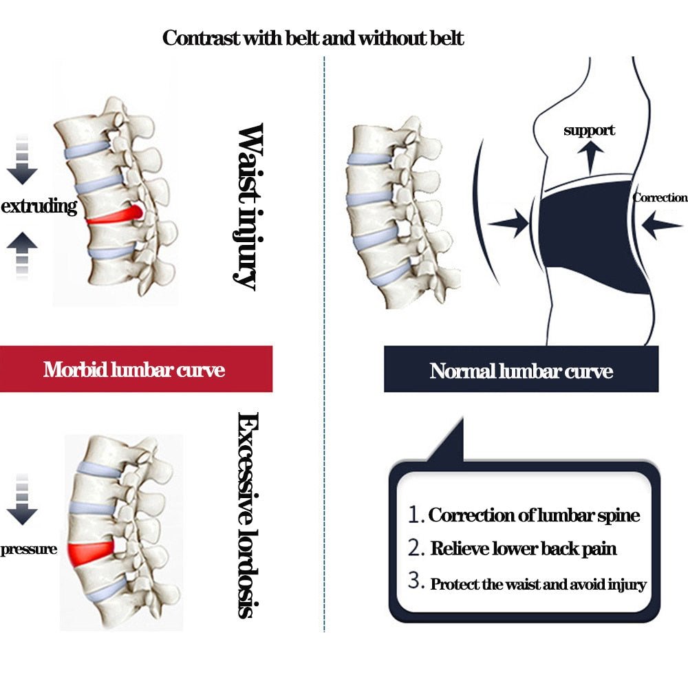Back Support Belt™ - Cartnoova