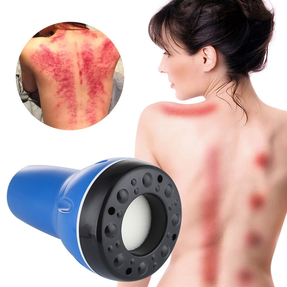 CuppyRecovery™️ - #1 Best Recovery Device for 2023 - Cartnoova