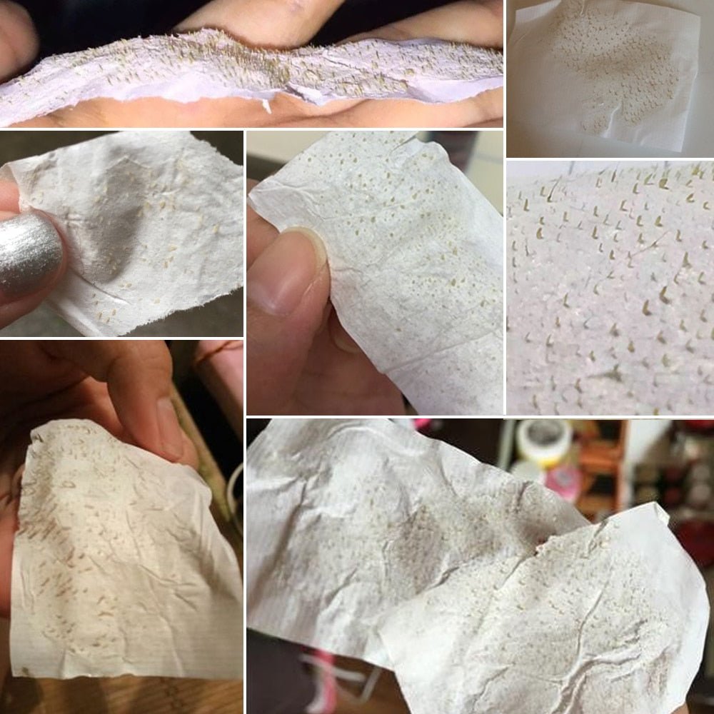 DermaStrips™ - 60PCS Blackhead/Whitehead Pore Strips - Cartnoova
