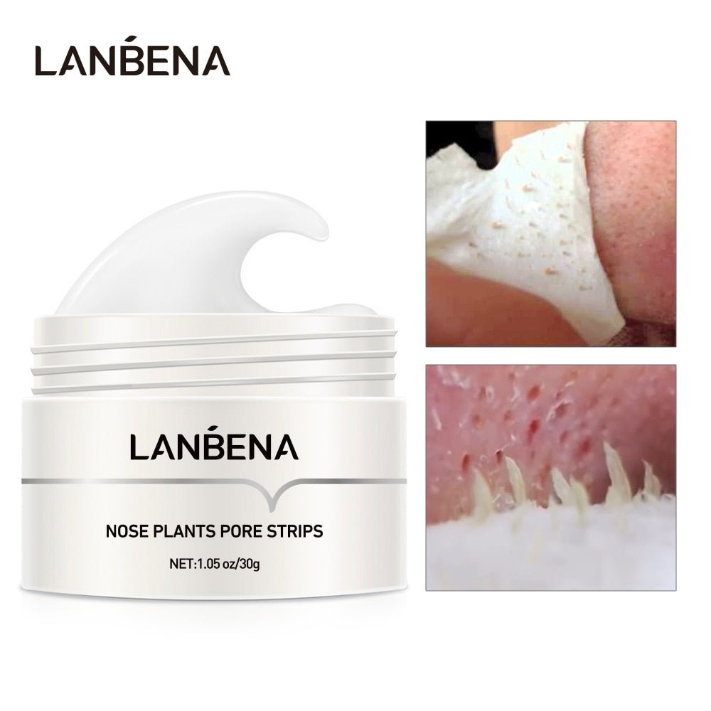 DermaStrips™ - 60PCS Blackhead/Whitehead Pore Strips - Cartnoova