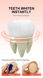 HeySmile ™ - Teeth Whitening Pen - Cartnoova