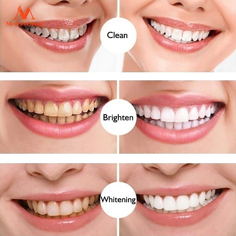 HeySmile ™ - Teeth Whitening Pen - Cartnoova