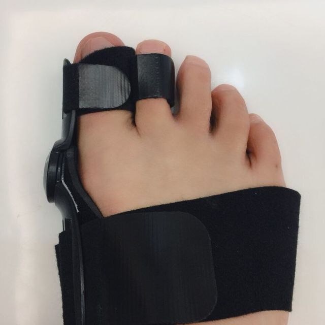 ToeCorrector™ - Flexible Orthopaedic Bunion Corrector - Cartnoova